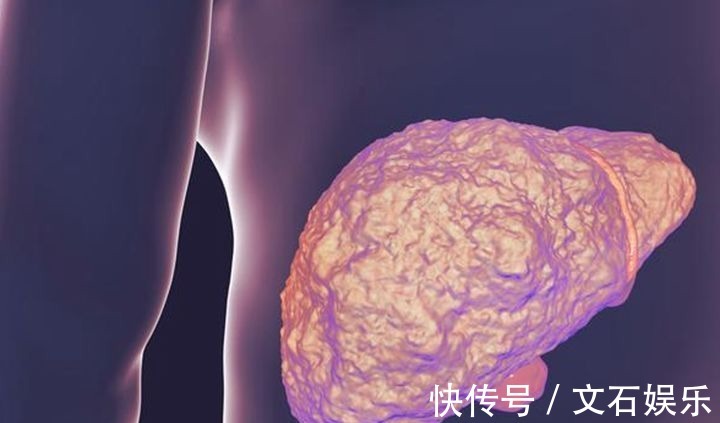 毒素|此物被称为“肝脏化毒王”,没事吃两口,肝硬化会自动退却!