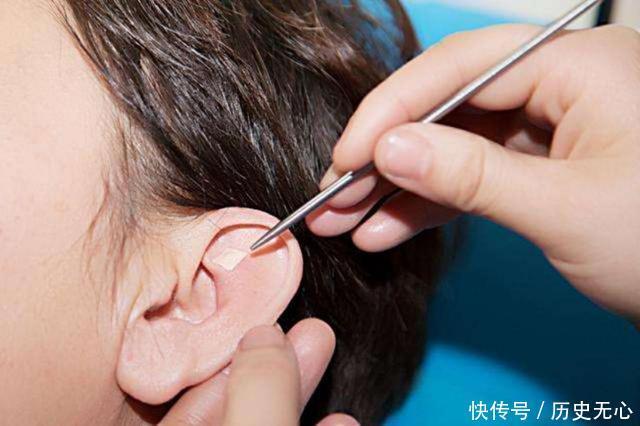 简单|耳穴压豆养生法,可能比针灸推拿疗法更安全简单,非常值得一试