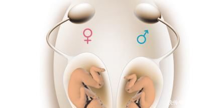 无创dn每20分钟就有一个唐氏儿出生，为什么很多孕妇不愿做唐筛产检？