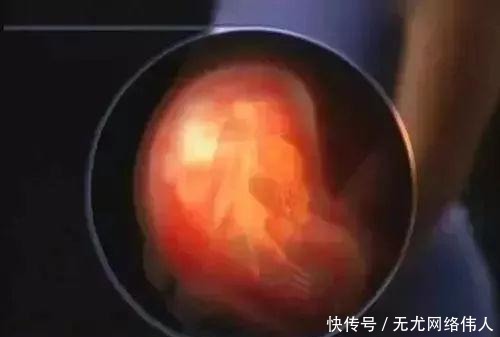 早产|一胎二胎间隔多久才能够再怀孕