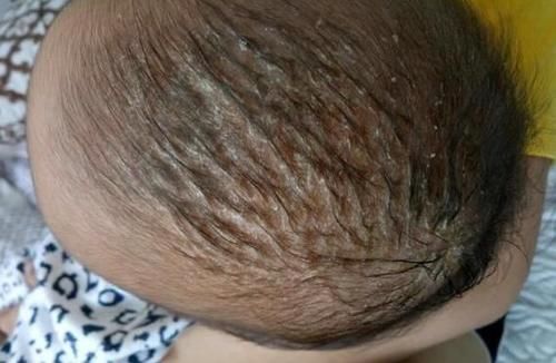 家长|不要对月子里新生儿做9件事，家长早知道早避坑，别影响娃的发育