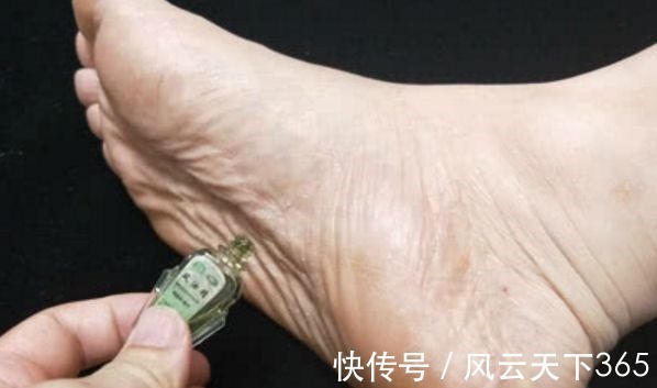 睡眠质量|家中常备风油精,涂在脚底坚持7天,看见效果老中医都说好!