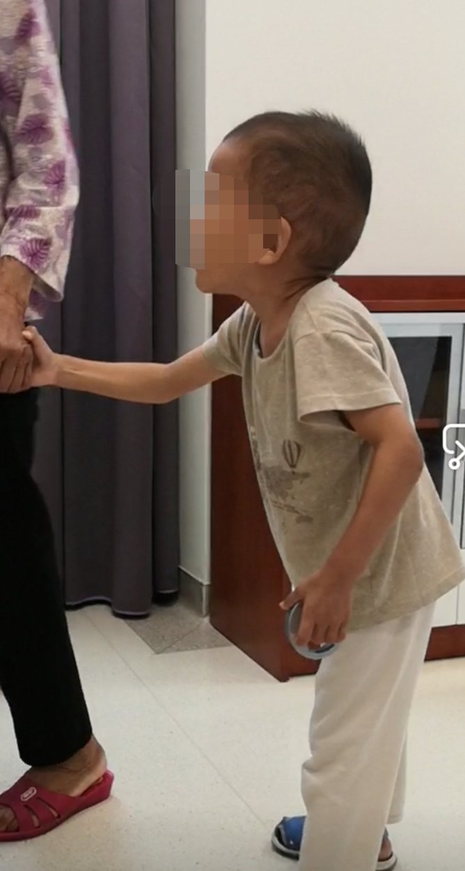 余加林教授|两岁半孩子近视2000多度，来深圳求医确诊患“天才病”