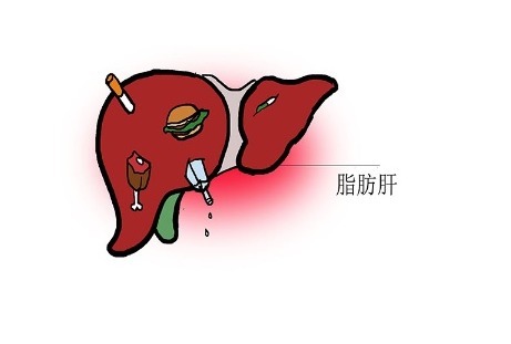 专家|查肝脏，选CT还是B超更好？哪个结果更准确？肝病专家告诉你