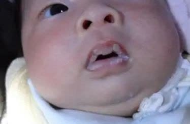 对策|超全15个新生儿常见问题及护理对策总结,新手爸妈速速收藏!