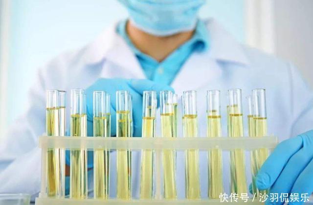 降尿酸的神器公布,苏打水并不排首位,敞开喝,尿酸回归正常