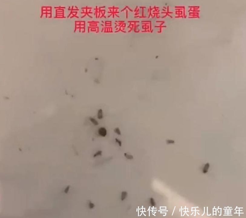 夹板|女儿被同学染上头虱,妈妈用热夹板一夹,下一幕引起舒适