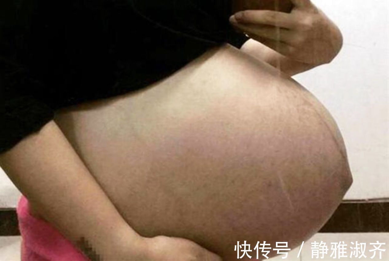 胎儿|一出生就荣获全球奖,曾经那个14.5斤的巨婴,如今过得怎么样了?
