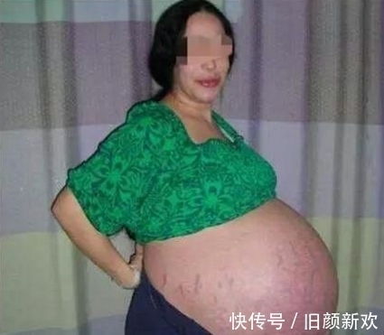 奶粉|孕妇剖腹产下八胞胎，丈夫不相信，看见孩子以后发愁奶粉钱