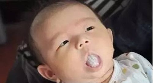 鼻梁|儿科医生孩子的病多是“吃”出来的,不想娃生病要注意“细节”