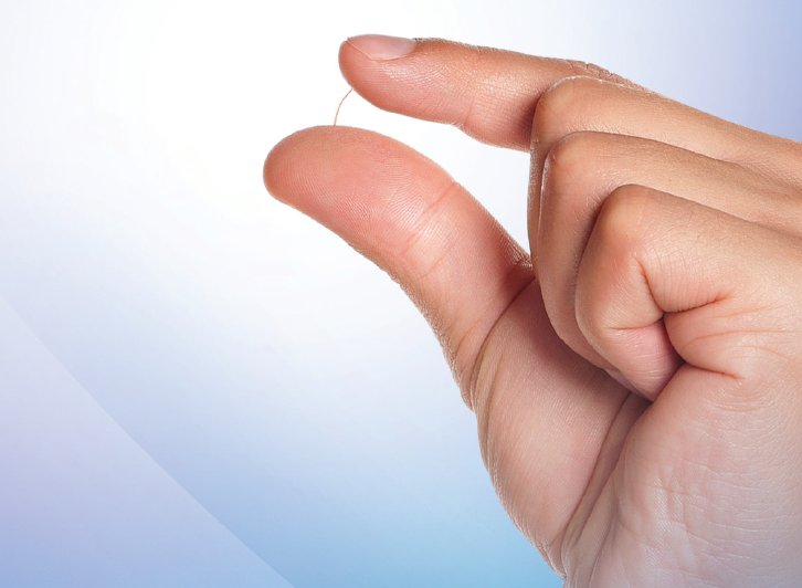 赖铭莹|深圳市眼科医院赖铭莹教授成功实施赞宜XEN青光眼引流管微创植入手术