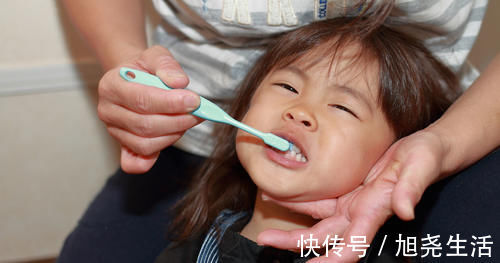 牙齿|牙科医生提醒:5类零食是孩子蛀牙的根源,孩子再馋也别吃