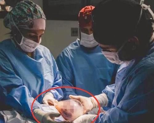 医生|孩子出生自带“金钟罩”,护士连连道喜,产妇:我生了个哪吒?