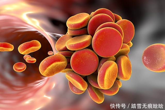  没事|血栓的“清洁工”发现了，不是醋，没事吃一点，血栓“躲着走”