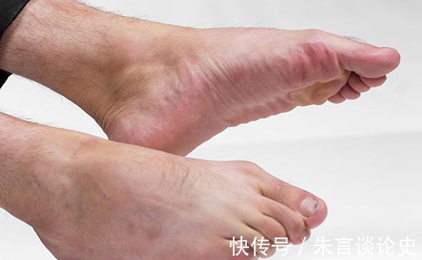 肌肉痉挛|睡觉时突然腿抽筋,就是缺钙?错!还有这几个原因,也不要忽视