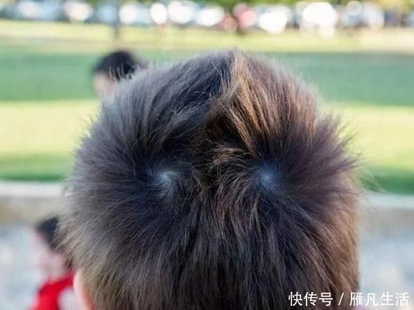 智商|孩子头顶有“2个旋”代表什么?和性格、智商有关吗?家长要清楚