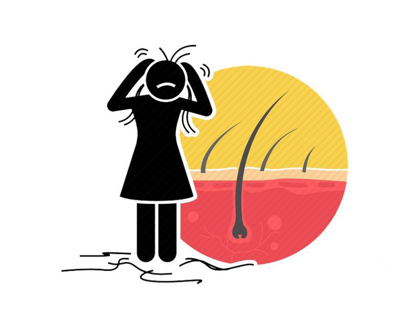 退行期|每6个人中就有1人脱发?要想守住发际线,这5件事需要做到位