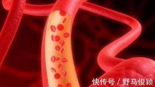 百病|中医直言血管一堵,易生百病,常吃5种蔬菜血管不再堵,别错过