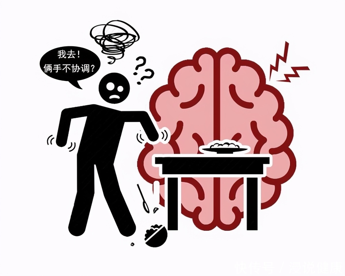 智力障碍|脑梗并非总搞“突然袭击”!一旦出现这4个迹象,请及时就医检查