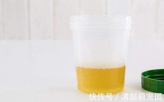 听力|男性开始衰老时,通常有“1大2小2臭”,若没有,说明你还年轻!