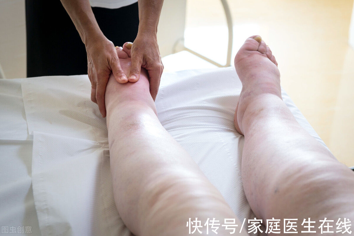 透析|肾友故事:没捉住“信号”,怕透析上瘾,他给尿毒症恶化推了一把