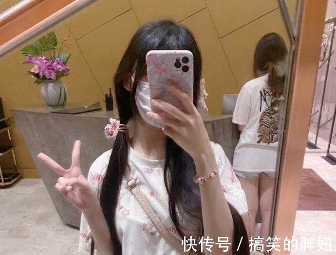 危机 蔡萝莉真的是一姐?出现秃头危机后,花10多万植发