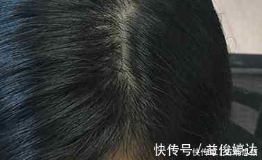 头皮|洗了几十年的头发,你可能第一步就做错了,难怪头发毛躁、没润泽