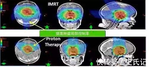 他把头伸进了粒子加速器,直接被接近光速的