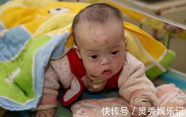 孩子|6个月婴儿紧握拳头,奶奶发现不对劲带去医院检查,医生:来晚了