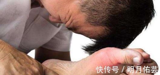 尿酸|3种“排酸高手”出现,家中常备,尿酸正常,痛风不敢靠近