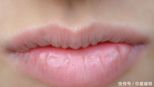 维生素E被称为女性的“好朋友”,但怎么吃才正确?医生告诉你