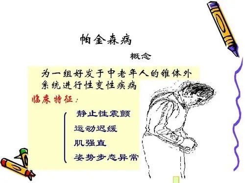 帕金森病患者|帕金森患者该如何锻炼身体呢