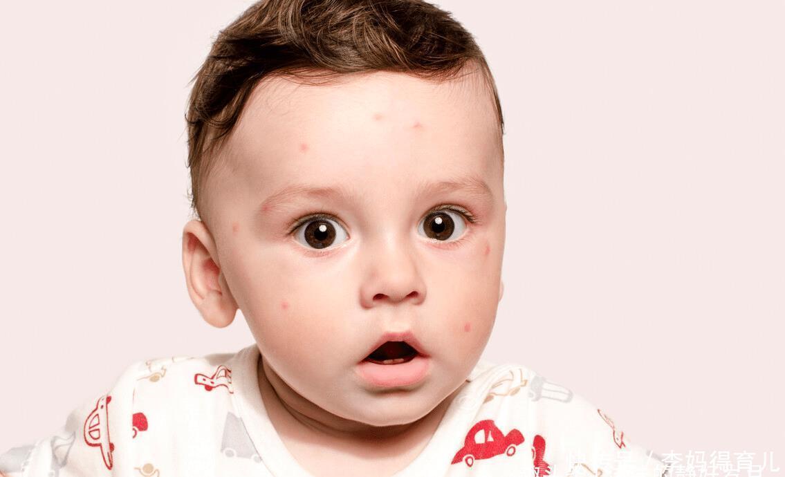 蚊子|嗡嗡嗡,你听你听,蚊子在狰狞的笑,它最喜欢小宝宝