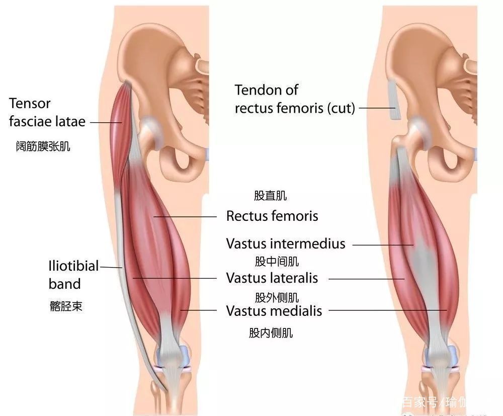 髂胫束|练瑜伽,髋部打不开,膝外侧疼常被忽视的髂胫束很重要