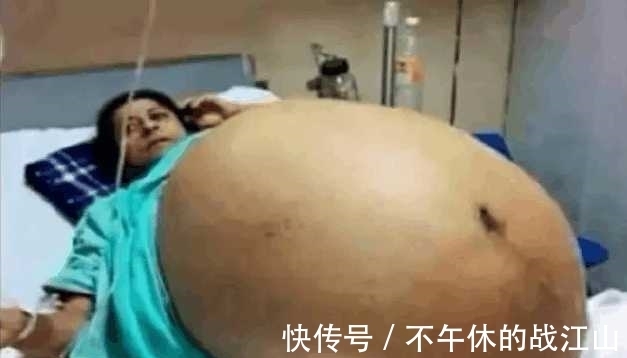 怀玉|女子肚大如鼓, 竟生下11胞胎, 结果却让全家人犯愁!