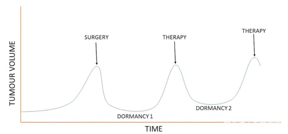 激素|如何延缓癌症复发教你3个方法,不花一分钱,让癌细胞休眠!