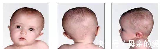 脖子|宝宝经常歪脖子危害大?原来是这几个原因,3招教你轻松解决