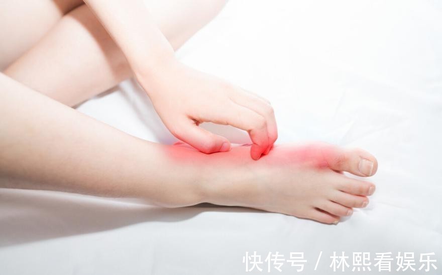 血管|血液“稀释剂”已公布,洋葱靠边站,每天补充一点,脑梗不接近