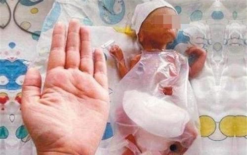 宝爸|世界上“最小的婴儿”，出生时1斤不到，现已长成挺拔少年