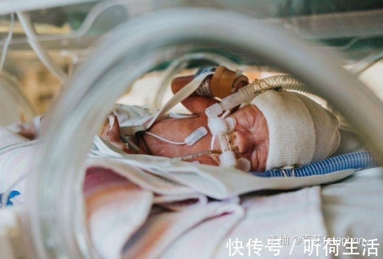 早产儿|7个月早产儿住保温箱花费10多万!保温箱为什么这么贵?