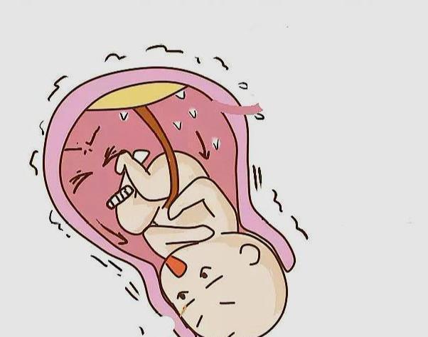 产科医生|生孩子越快越好吗?妇产科医生告诉你:生孩子太快不是好事!