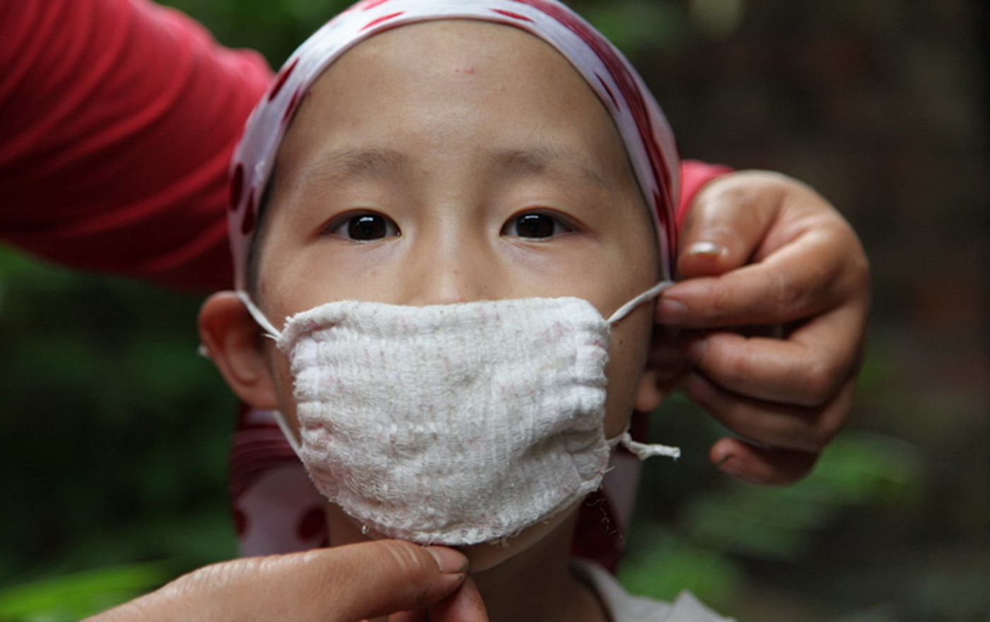 儿童已成白血病高发群,这些水果是“隐患”,别再给孩子吃了