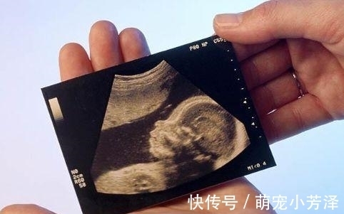 胎宝|22周四维彩超第一次见胎宝,被丑哭,这些原因导致胎儿看起来丑