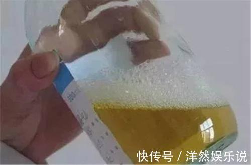 脱皮|肝有问题,“下半身”会有3个症状,若是还没有,说明肝还不错