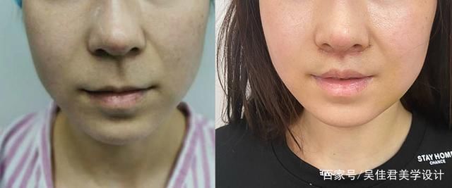 从老阿姨到小姐姐，降低年龄感她选择这样做！