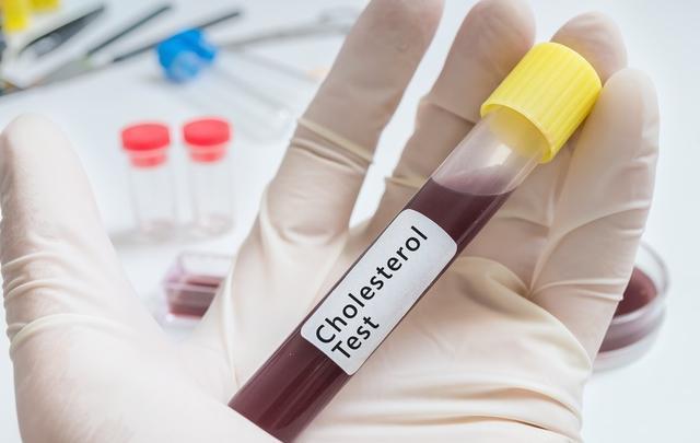 跑步|高血脂通过跑步能降下来吗要跑多久才可以本文讲出实情