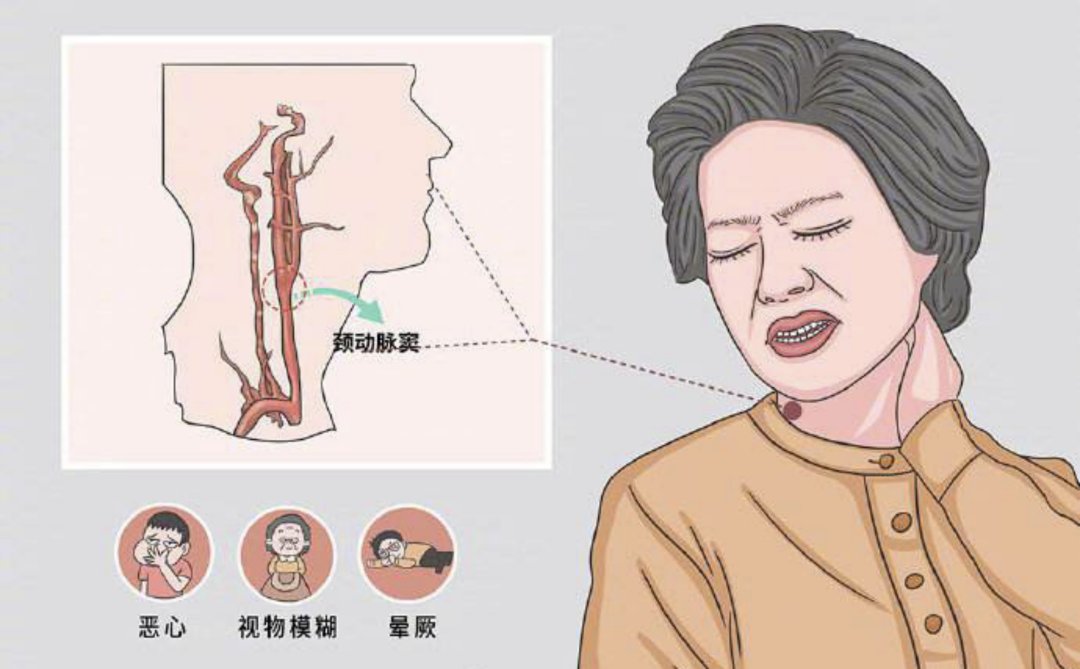 老师 福州年轻老师突然倒在讲台上，竟因穿高领毛衣…冬天这么穿要小心！