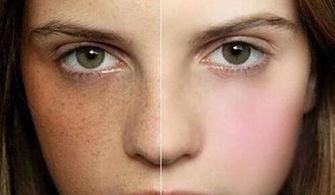 颈动脉|颈动脉若有斑块,身体会有什么表现?该注意什么?