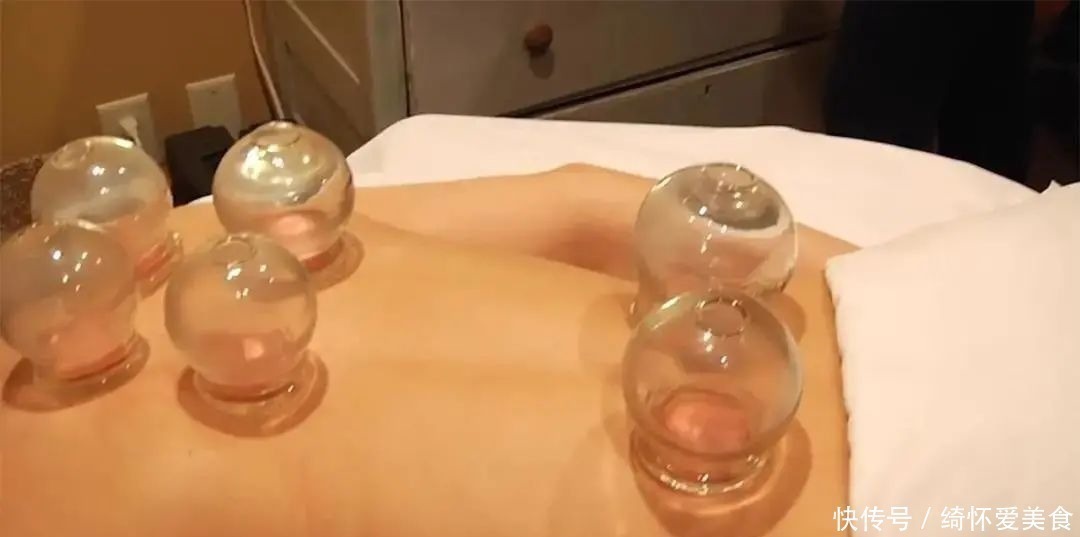 湿气|拔火罐到底吸出来是湿气,还是毒素?答案或和你想的不同