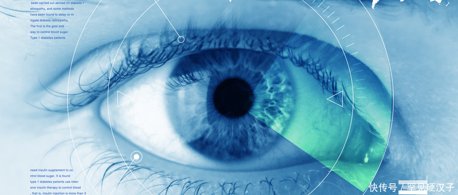 蚊子|眼睛总是看到蚊子,如何治疗有3种治疗方法,可以帮到你